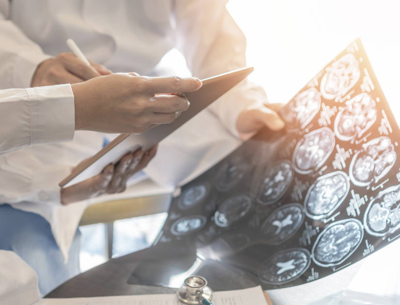 A group of doctors review a sheet of brain scans